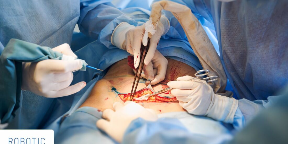 Inguinal hernia surgery